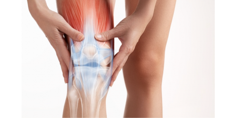 ¿Por qué te duele el hueso? Todo lo que debes saber sobre el edema óseo